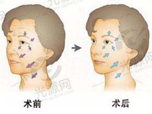 二、上海整形手术收费情况