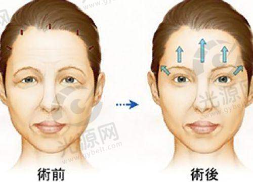 一、深圳圣浩齿科靠谱吗?医院资料与资质解析