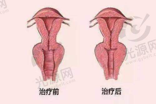 总结