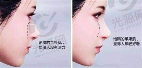 朝阳二院美容科面部吸脂项目价格