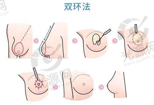 颌面整形:骨干医生与技术保护