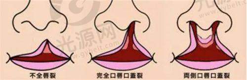 北京黄寺整形外科医院真实实例分享
