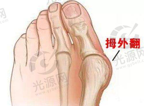 面部脂肪室复位提升手术排名情况