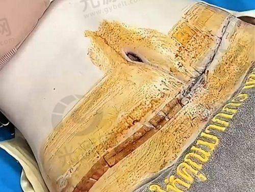 北京黄寺整形外科医院的热门项目及价格