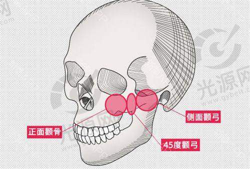 热门项目:拉皮与吸脂的魅力