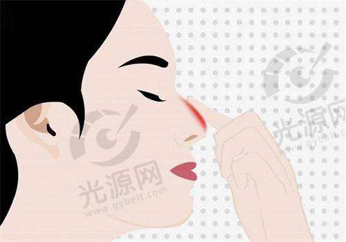 穆宝安大拉皮手术价格及套餐
