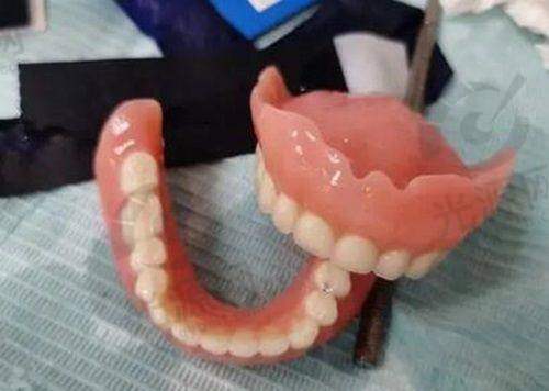 高春菊医生:舌侧正畸的导师