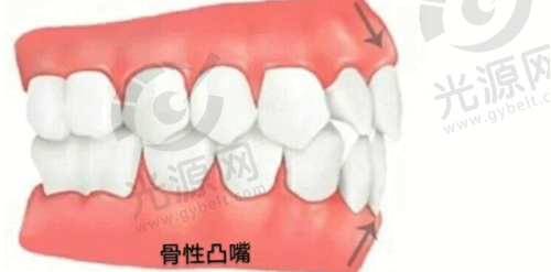 深圳格伦菲尔口腔医院的口碑怎么样
