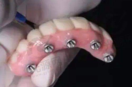 便捷的连锁布局