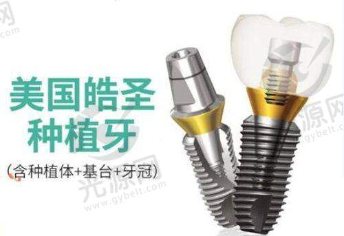 精良技术：提升全口种植牙的成功几率