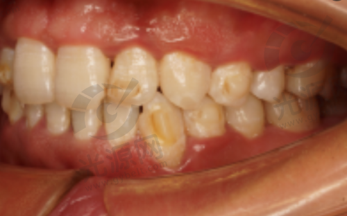 上海鼎植口腔连锁是公立医院还是私立医院？是私立医院，特色技术、优质医生与实惠价格带来满意诊疗体验 
