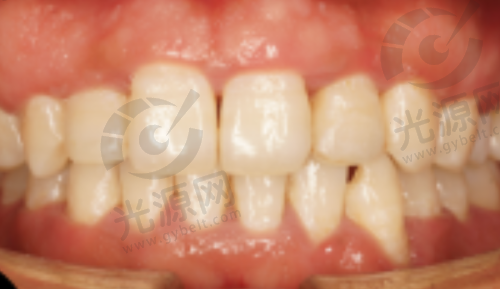 与其他口腔医院的对比优势
