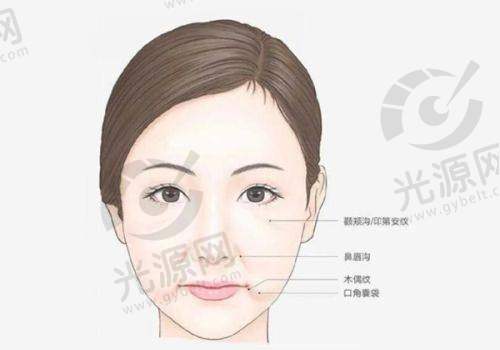 v 美减龄面部提升适应人群