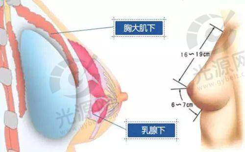 吸脂项目:价格与技术优势