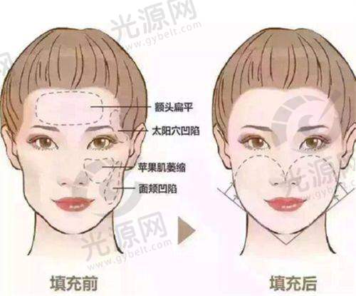 避坑指南:选择北京加减美,远离不良机构