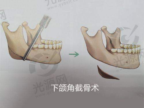 北京黄寺整形外科医院:给你的求美建议