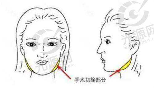 北京加减美医院优势:专精可靠的医美机构