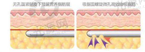 面部整形:自然精细,个性化打造