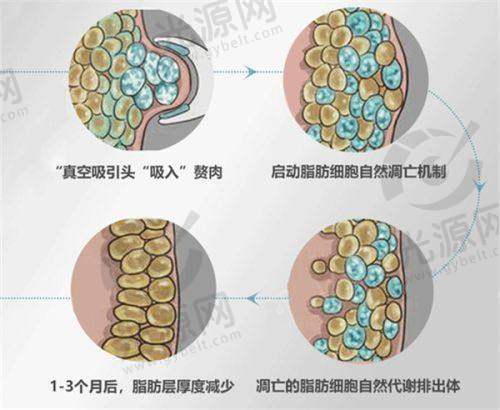 李晓东医生:面部提升技术的创新先锋
