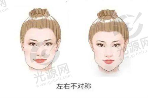 与其他面部提升医生收费对比