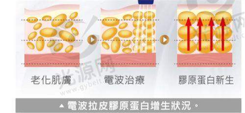 如何预约杜太超医生的大拉皮手术