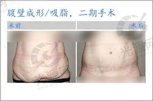 大同凤凰妇产医院整形科特色项目