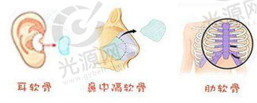 北京黄寺整形医院大拉皮手术避坑指南