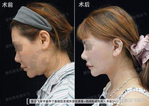 穆宝安与黄寅守医生技术大比拼