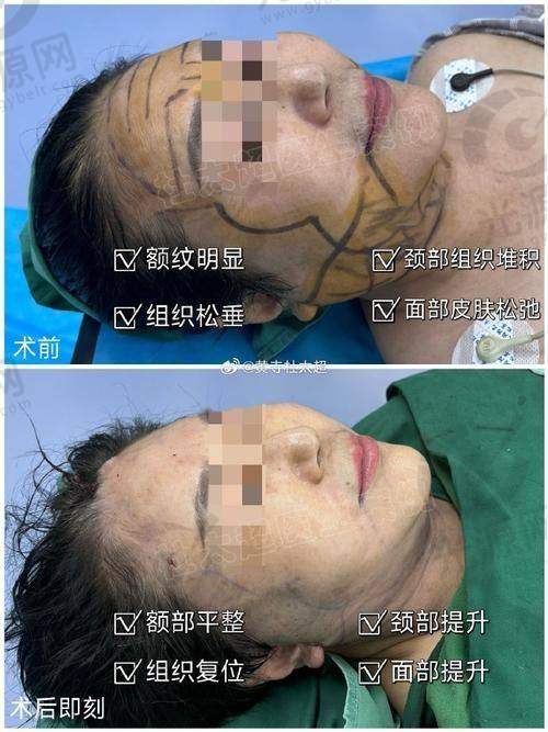 预约穆宝安医生的注意事项