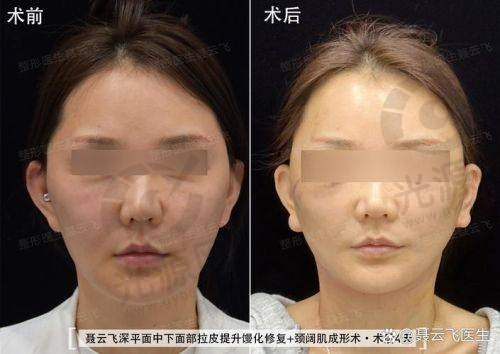 北京加减美医疗美容：专精的面部提升机构