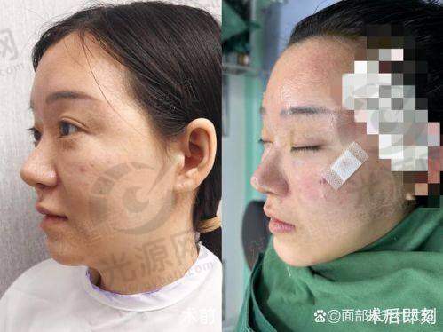 北京加减美医疗美容穆宝安和黄寅守哪个好？都有各自的优势和特色，在面部提升领域都有着出色的表现