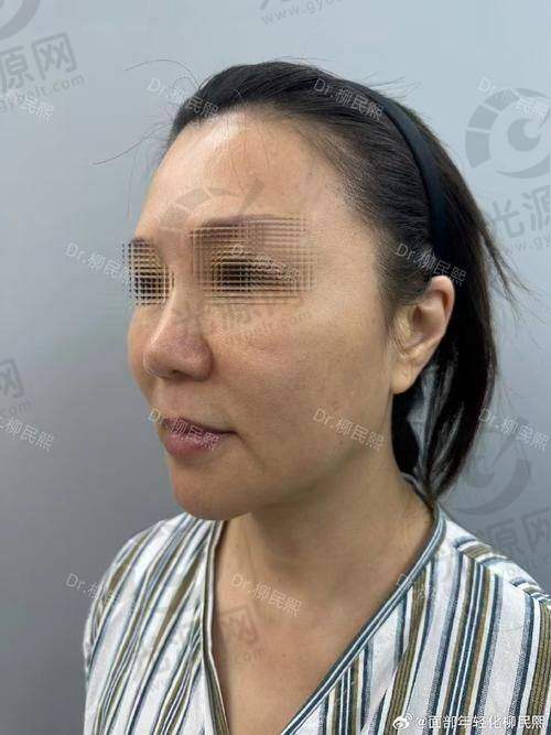 北京加减美医疗美容穆宝安坐诊时间需提前3个月预约，精湛面部提升技术助您焕颜！ 