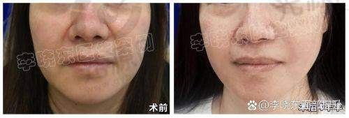 患者评价：穆宝安与黄寅守的真实反馈
