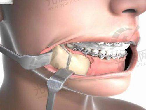 5. 北京嘉禾医疗美容医院