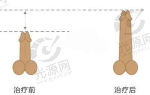 8. 北京画美医疗美容医院