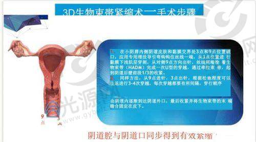 术后修复与注意事项