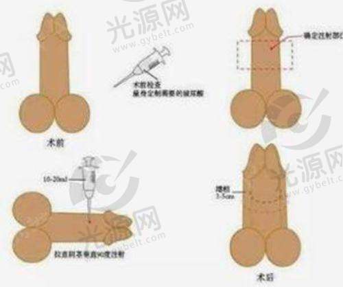 3. 北京佰华利整形医院