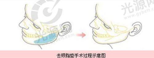 三、真实实例分享,口碑见证成效