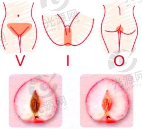 三、景德镇疤痕修复项目收费情况