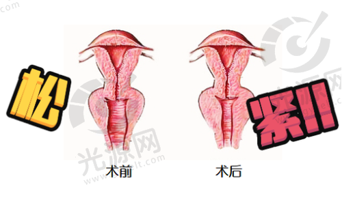 二、景德镇哪家医院可以修补处女每家医院的详细介绍