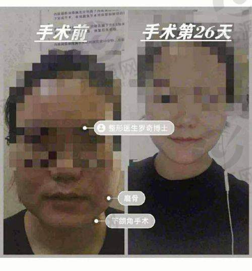 预约挂号与沟通