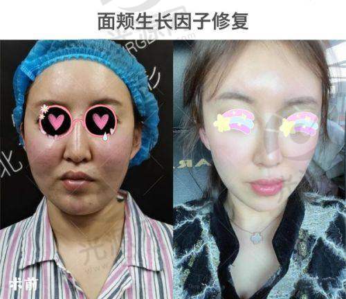 西安圣梦医疗美容门诊部多项胸部整形价格曝光，隆胸、缩乳及修复费用全知晓