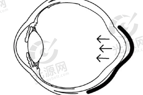 西安大麦植发医疗美容诊所FUE植发21645元起，眉发疤发及美人尖种植各有优惠