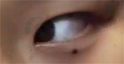 西安英蓓仪医疗美容诊所的优势与特色