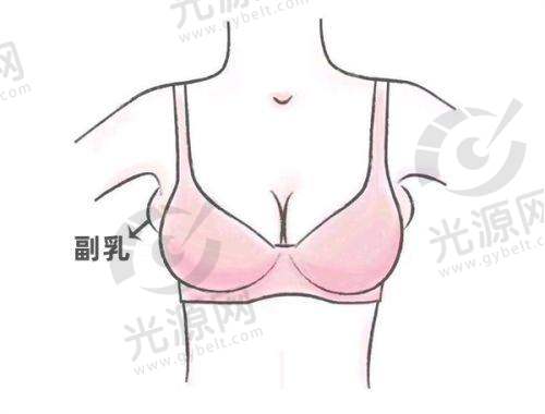 冯斌医生手术实例展示