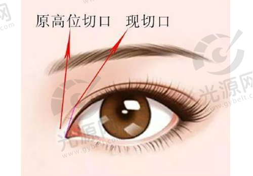 重庆星荣整形外科医院的特色项目及价格