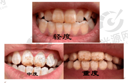 北京劲松口腔医院怎么预约挂号之公众号预约