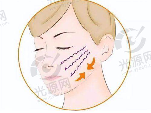 特色技术:引领脂肪整形新潮流