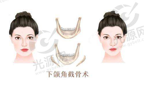 专精医生团队:为美丽保驾护航
