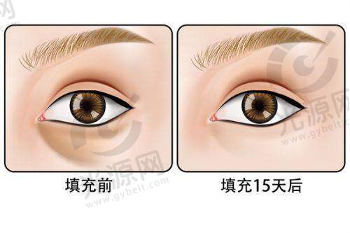 北京纯脂脂肪专科的明星效应